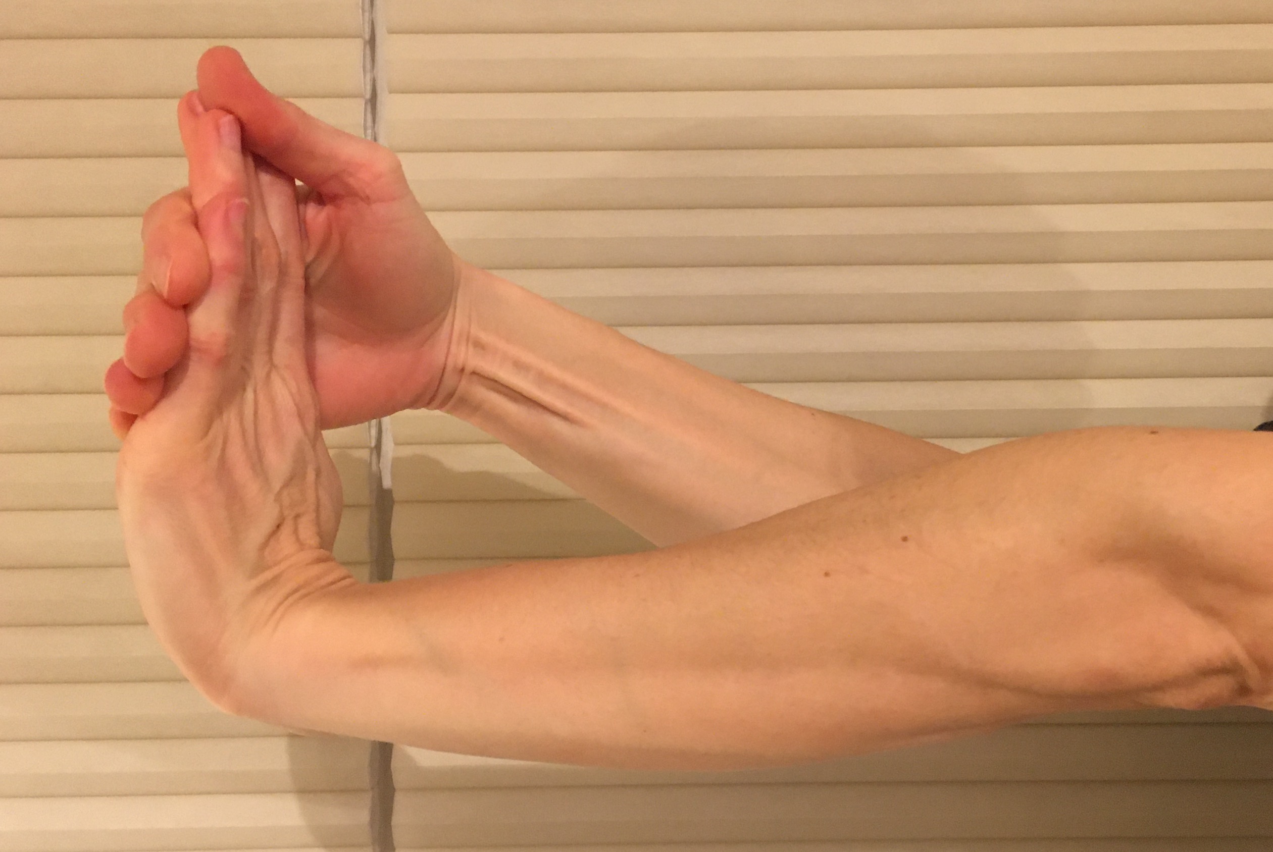 Wrist-extension